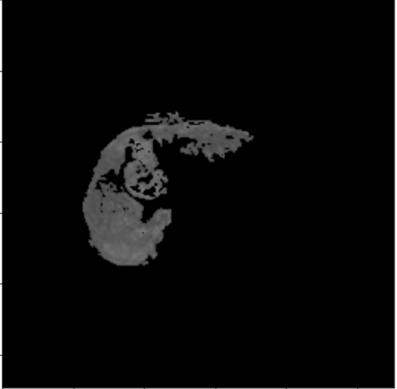 Sid Sid Jrtzb Roboflow Universe