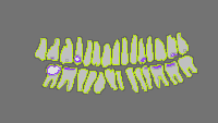 Annotation Visualization