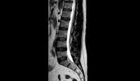 sagittal/l4-l5 project thumbnail