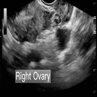 Follicle Instance Segmentation project thumbnail