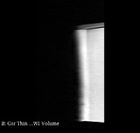 MRI_Prostate_Phantom project thumbnail