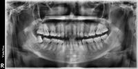 Dental Disease Detection Master project thumbnail