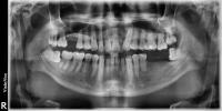 Dental Detection Master project thumbnail