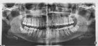 Apex_crown project thumbnail