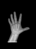 x-ray-id-zfisb-fsod-kxxa project thumbnail