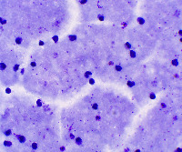 malaria_thicksmear_4class project thumbnail