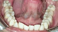 Mandibular project thumbnail