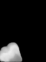 caries again project thumbnail