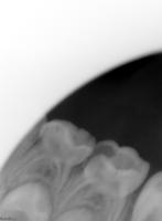 teeth-finalized-labelled-corrected project thumbnail