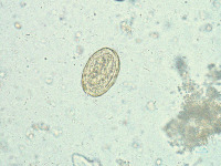 Combined Helminth Eggs Dataset project thumbnail