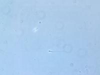 Gracilis vs Turneri project thumbnail