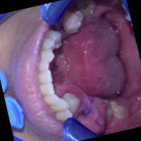 oklusal bawah bounding box lgi project thumbnail