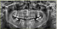 dental-train project thumbnail
