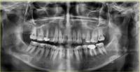 dental data_obje project thumbnail