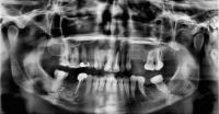 dental-yeni project thumbnail