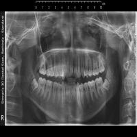 dental project thumbnail
