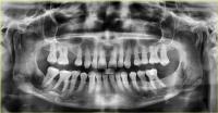 dental data_102 project thumbnail