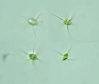 algae ecoli project thumbnail