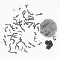 chromosomal abnormalities project thumbnail