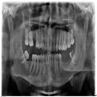 new dentamap project thumbnail