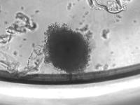 Speroid segmentation project thumbnail