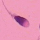 sperm project thumbnail