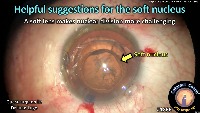 K_CC_1866_helpful suggestions project thumbnail