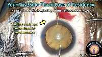 K_CC_1881_first solo project thumbnail