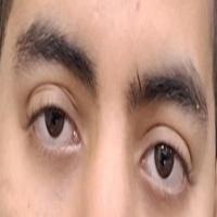 My First Project project thumbnail