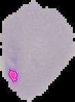 malariadetection_new project thumbnail