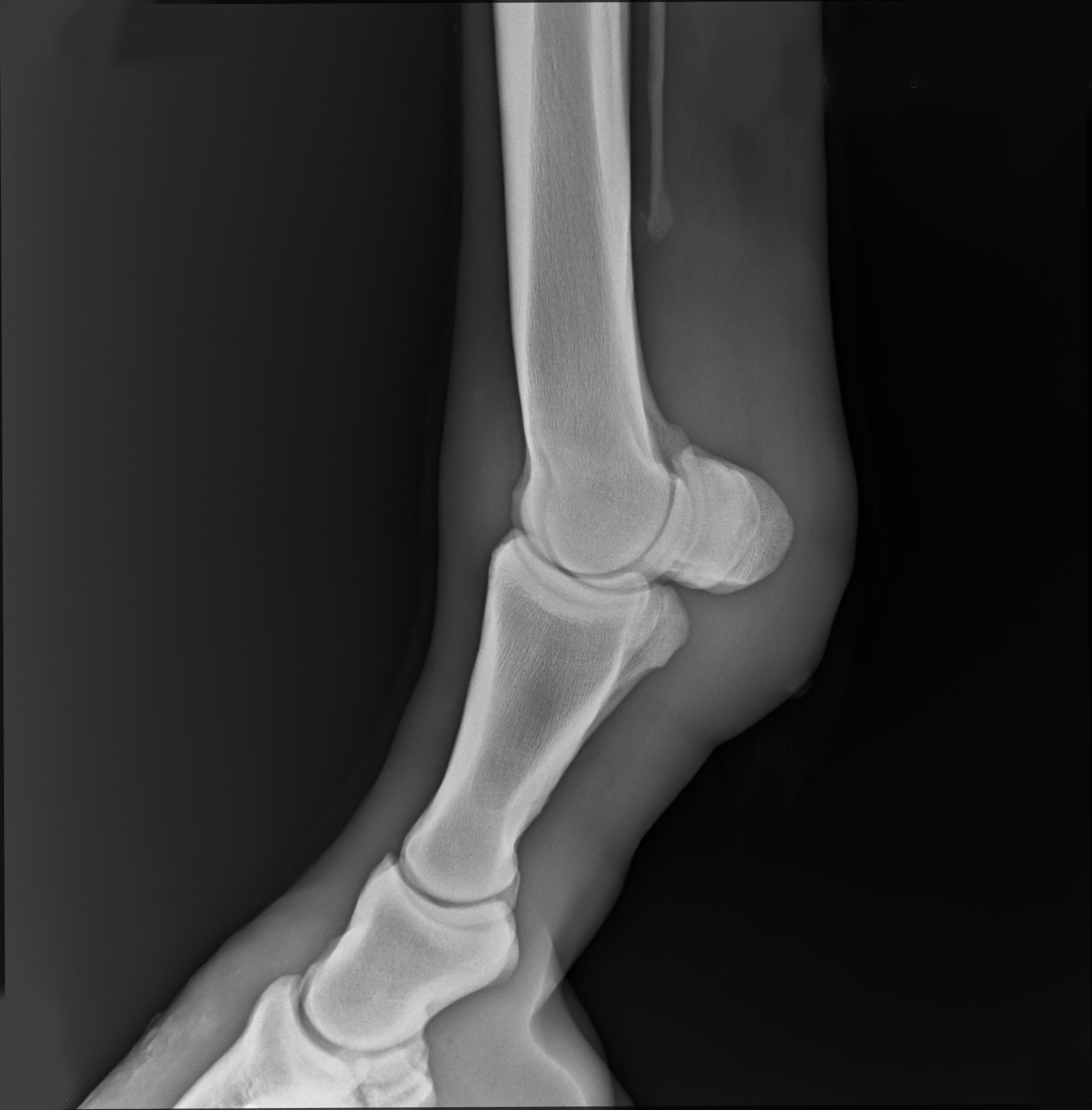 get_knee Object Detection Dataset and Pre-Trained Model by northeastern ...