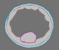 Annotation Visualization