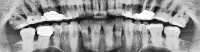 Bone_cropped_images project thumbnail