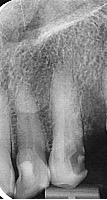 anterior PA Elham project thumbnail