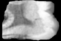 XÑRadiogra project thumbnail