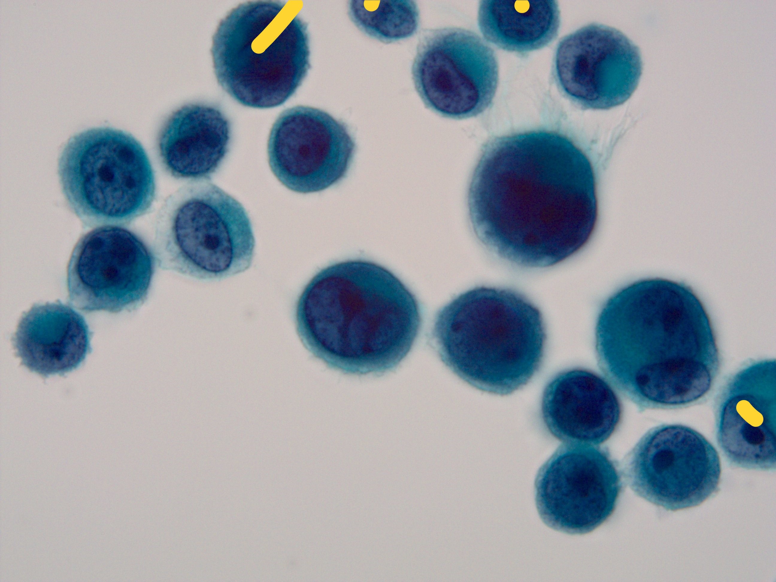 TE8_InSeg_YAMAMOTO Instance Segmentation Dataset by SOTSUKEN