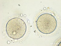 Oocyte Recognition project thumbnail