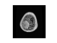 Figshare dataset brain region  project thumbnail