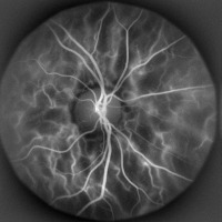 Eye side project thumbnail