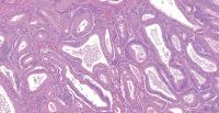 tubule segmentation project thumbnail