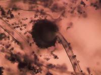 Aspergillus project thumbnail