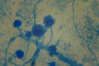 Aspergillus-YOLO project thumbnail