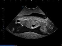 Spine sagittal view project thumbnail