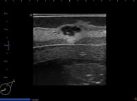 long axis, LIQ lesion project thumbnail