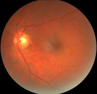 Dataset Image