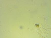 Bacillus subtilis project thumbnail