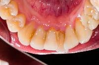 oral project thumbnail