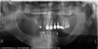 X-ray project thumbnail