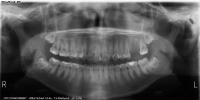 X-ray project thumbnail
