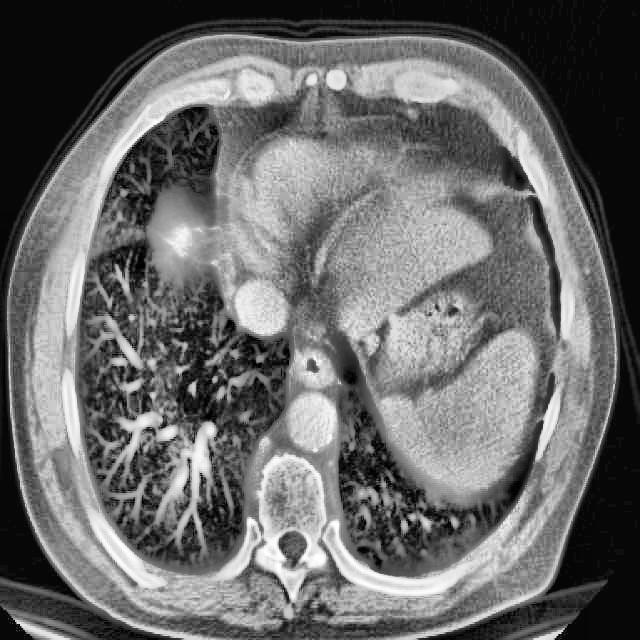 Full Body MRI Classification Classification Dataset and Pre-Trained ...